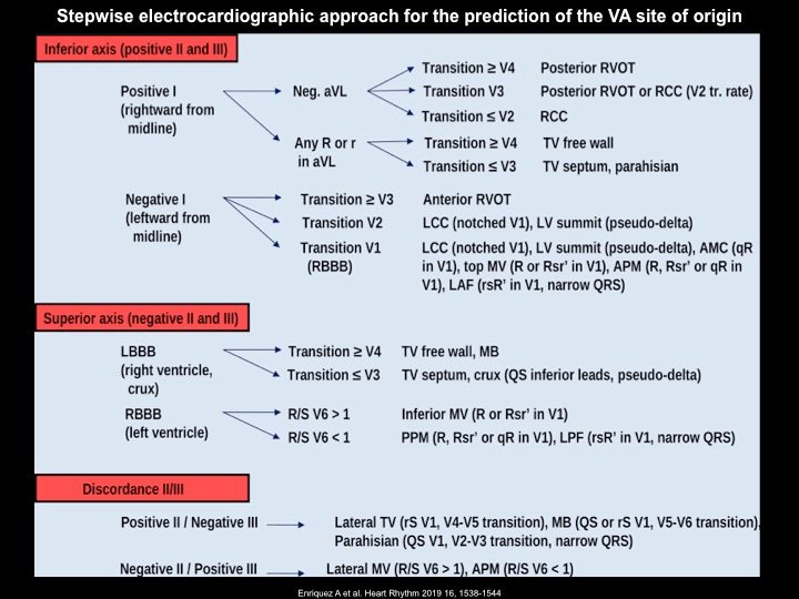 Raviele Antonio (@drraviele) on Twitter photo Great paper on the value of 12-lead surface ECG in localizing the most likely site of origin of idiopathic ventricular arrhythmias <a href="/adribaran/">Adrian Baranchuk MD FACC FRCPC FCCS FSIAC</a> <a href="/DrFerminGarcia/">Fermin Carlos Garcia</a> @andreanatalemd <a href="/DrRoderickTung/">Roderick Tung</a> <a href="/LuigiDiBiaseMD/">Luigi Di Biase</a> <a href="/Dr_Santangeli/">Pasquale Santangeli</a> <a href="/HRSonline/">Heart Rhythm Society</a> #HeartRhythm doi.org/10.1016/j.hrth… Great paper on the value of 12-lead surface ECG in localizing the most likely site of origin of idiopathic ventricular arrhythmias <a href="/adribaran/">Adrian Baranchuk MD FACC FRCPC FCCS FSIAC</a> <a href="/DrFerminGarcia/">Fermin Carlos Garcia</a> @andreanatalemd <a href="/DrRoderickTung/">Roderick Tung</a> <a href="/LuigiDiBiaseMD/">Luigi Di Biase</a> <a href="/Dr_Santangeli/">Pasquale Santangeli</a> <a href="/HRSonline/">Heart Rhythm Society</a> #HeartRhythm doi.org/10.1016/j.hrth…