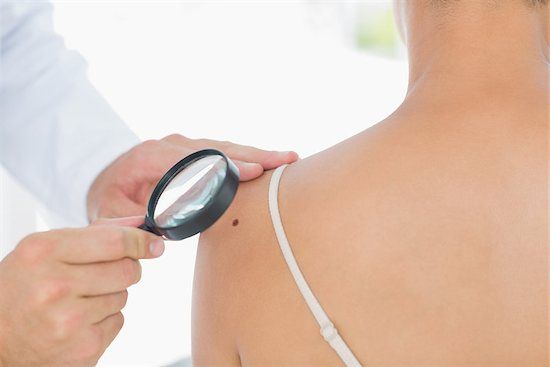 Melanoma Stages: Prognosis, Survival Rates and Treatment buff.ly/2IMxCyy