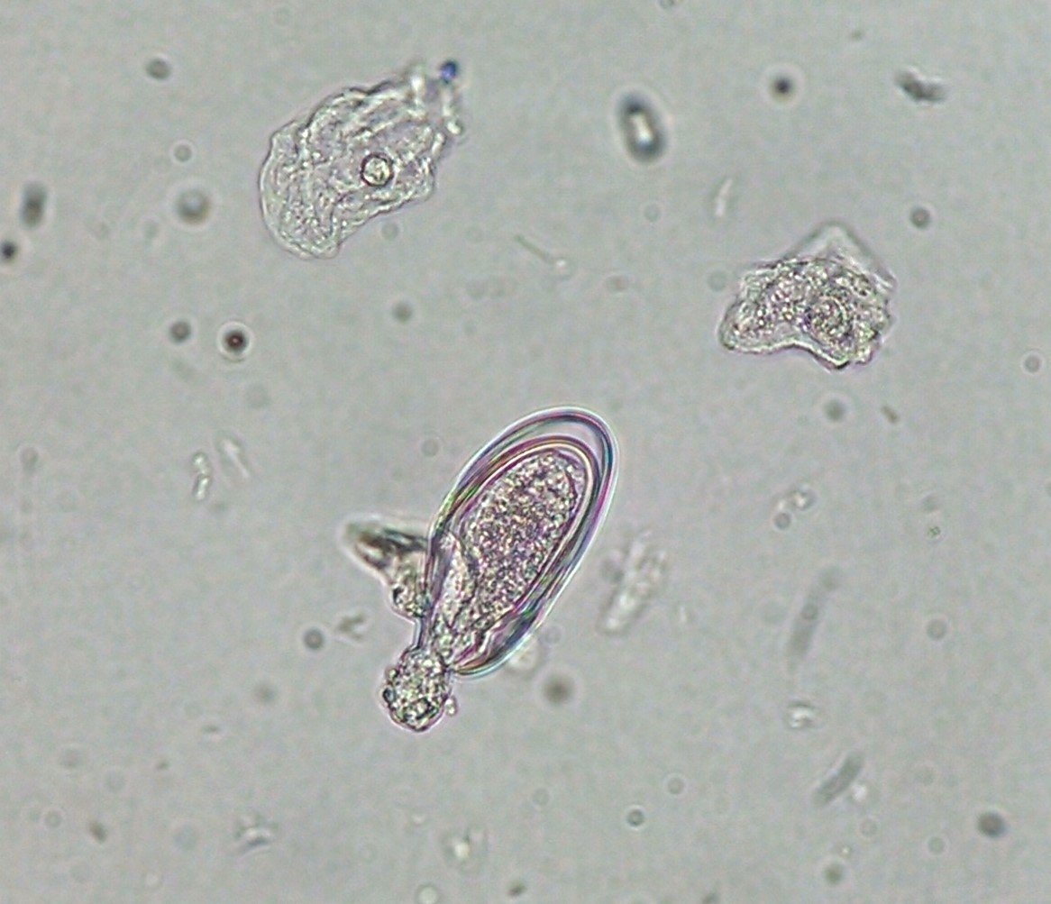 papilloma viren impfung sós víz méregtelenítése