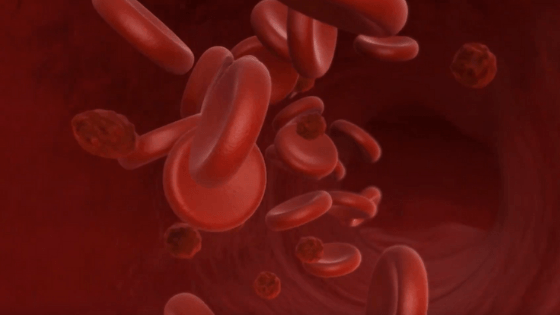IntellectAdi's tweet photo. Symptoms of Vasculitis:

Skin: Clusters of small dots, red or purple or spots or bumps, bruises, blemishes, hives, itching
Joints: Pain or arthritis in joints
Lungs: Coughing up blood and breath shortness

Read more: https://t.co/TZwlP315AD

#medical #Vasculitis #medicalanimation https://t.co/CZrbsNfMzg