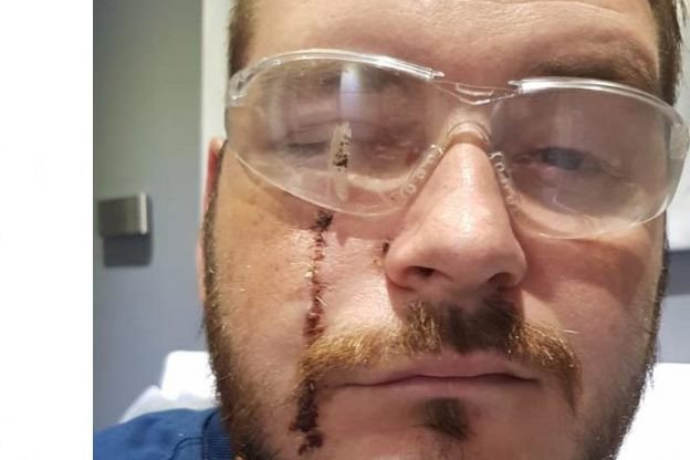 A plumber from Leeds who survived a potentially fatal #accident at work is fronting a campaign to build awareness that not all #PPE is the same - bit.ly/2BJqAGS