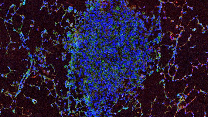 ACTforCancer's tweet photo. Amazing work from @EdinburghUni. Researchers are using a new type of chemical probe to detect key cells, aiding early diagnosis and patients treatment. Better treatments lead to better results for patients. https://t.co/BWQl7dJkUe #actforcancer #edinburgh #cancer #science #health https://t.co/3Hmejt8taA