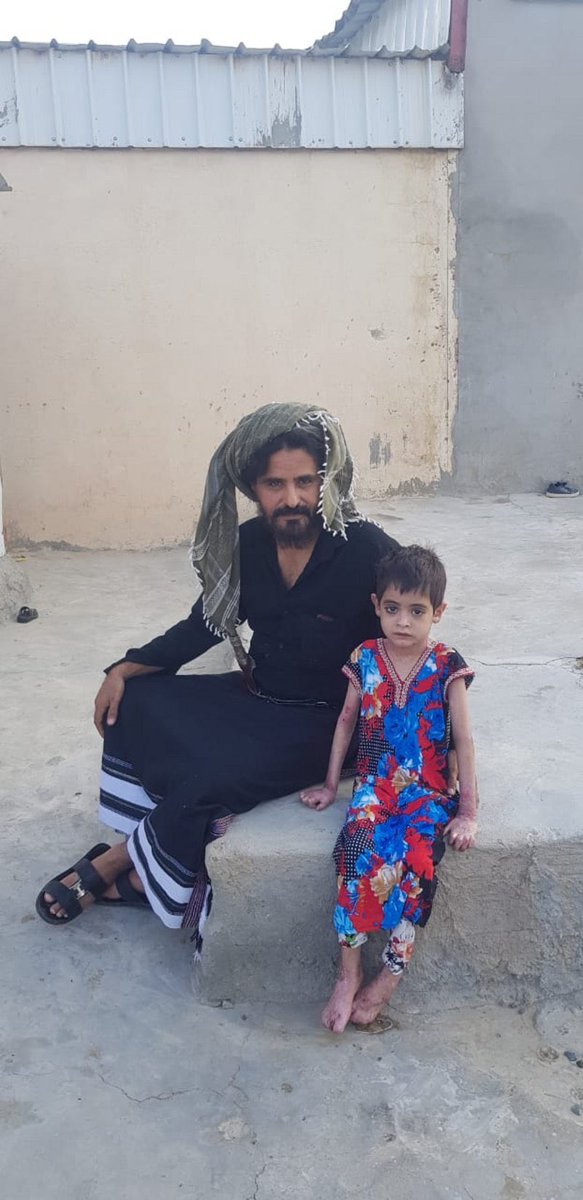 tmoh__2019's tweet photo. حالة انسانية |

" والد الطفلة "جالية جابر أحمد السلمي"، يناشد الجهات العليا والمختصة، علاج طفلته التي تُعاني من مرض انحلال البشرة الفقاعي، الذي بات يهدد حياتها؛ مبينًا أنه فَقَدَ اثنتين من بناته قبلها تُوفّيتا بسبب معاناتهما مع المرض.
@fayez_malki https://t.co/LmATwy9ntj