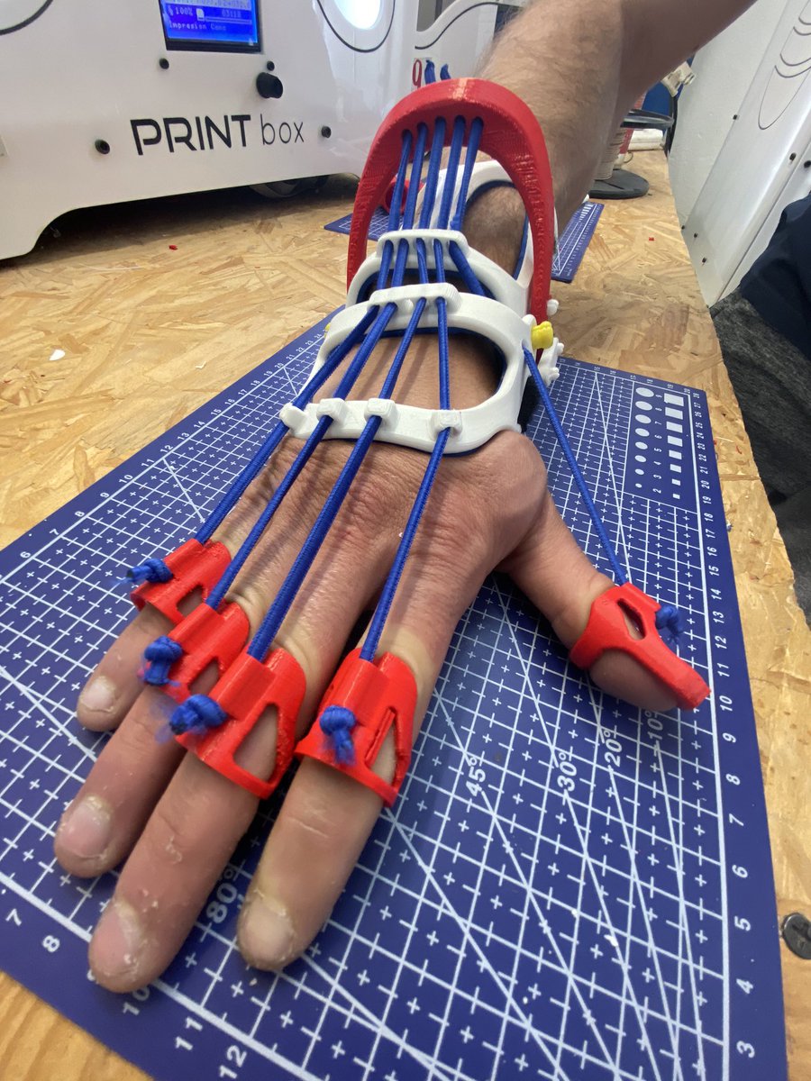 ginotubaro's tweet photo. Preferentemente la persona tiene que estar en CABA. Acá hay un par más de fotos del dispositivo, la idea es hacerlo a medida de la persona (necesitaríamos una foto de la mano sobre una hoja cuadriculada). https://t.co/8XPFaA3Lzv