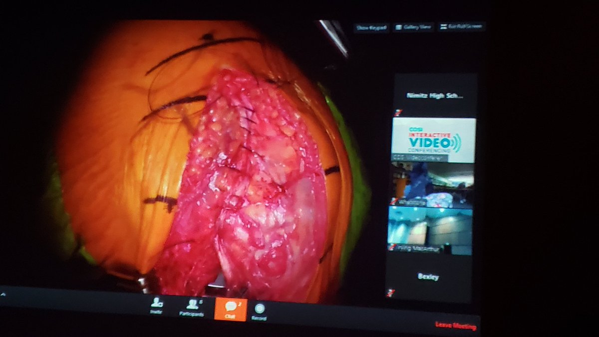 PranaThoppil's tweet photo. #COSIKnee @NimitzVikings #NimitzNation #NimitzVikings #MyIrvingISD #NimitzCTE @iisdCTE #ThoppilAnatomy #ThoppilForensics closing up the knee https://t.co/i0F0z1oYcw