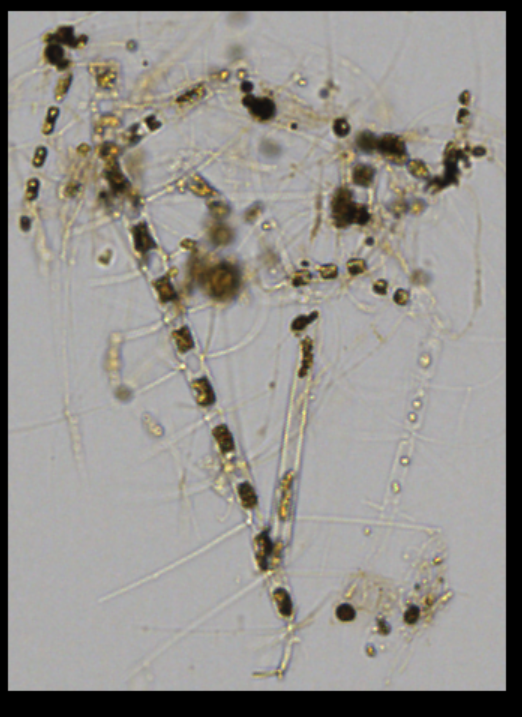 e_garciamartin's tweet image. Back to the lab @NOCnews. #Arctic #plankton from the #DIAPOD project through the #FlowCam @FluidImaging . I’ve made a composition to show the #biodiversity. Some of them are like my hair: a complete mess 🙂