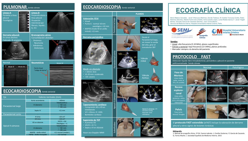GTECOSEMI's tweet photo. Un gran trabajo de síntesis por parte de nuestros compañeros del HU Infanta Cristina. Para llevar en el móvil o en la bata. Buen trabajo y gracias por compartirlo! #POCUS https://t.co/2NpTrIWJqg