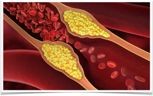 Stress is linked to many health conditions which adversely affect your health. High blood pressure is one of those - with high blood pressure increasing your risk of mortality. Read more about how to measure yours and how stress affects it here: workingwell.co.uk/post/the-cost-…