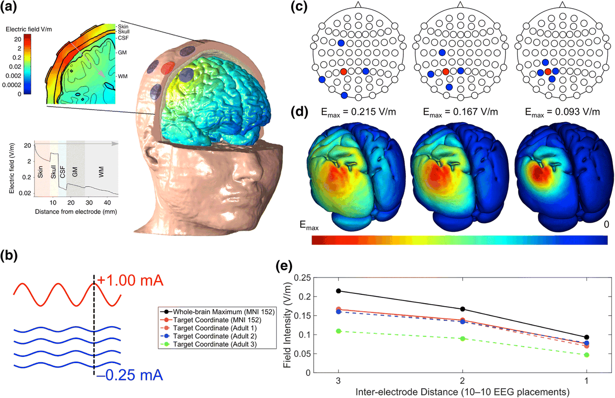 Experimental Brain Research tweet media