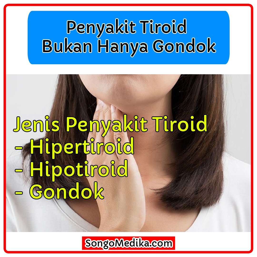 Hipotiroidi-Tiroid Tembelliği