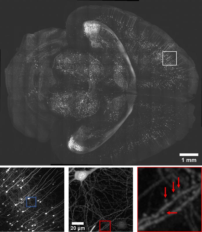 nanobay_'s tweet photo. Scientists @leibniz_ipht, @unijena, @FiolkaLab, @UTSWNews, @heintzmannlab Develop New Method to Map Brain Structures.
https://t.co/F8oQ8AJCjd https://t.co/VUDznhrbL8