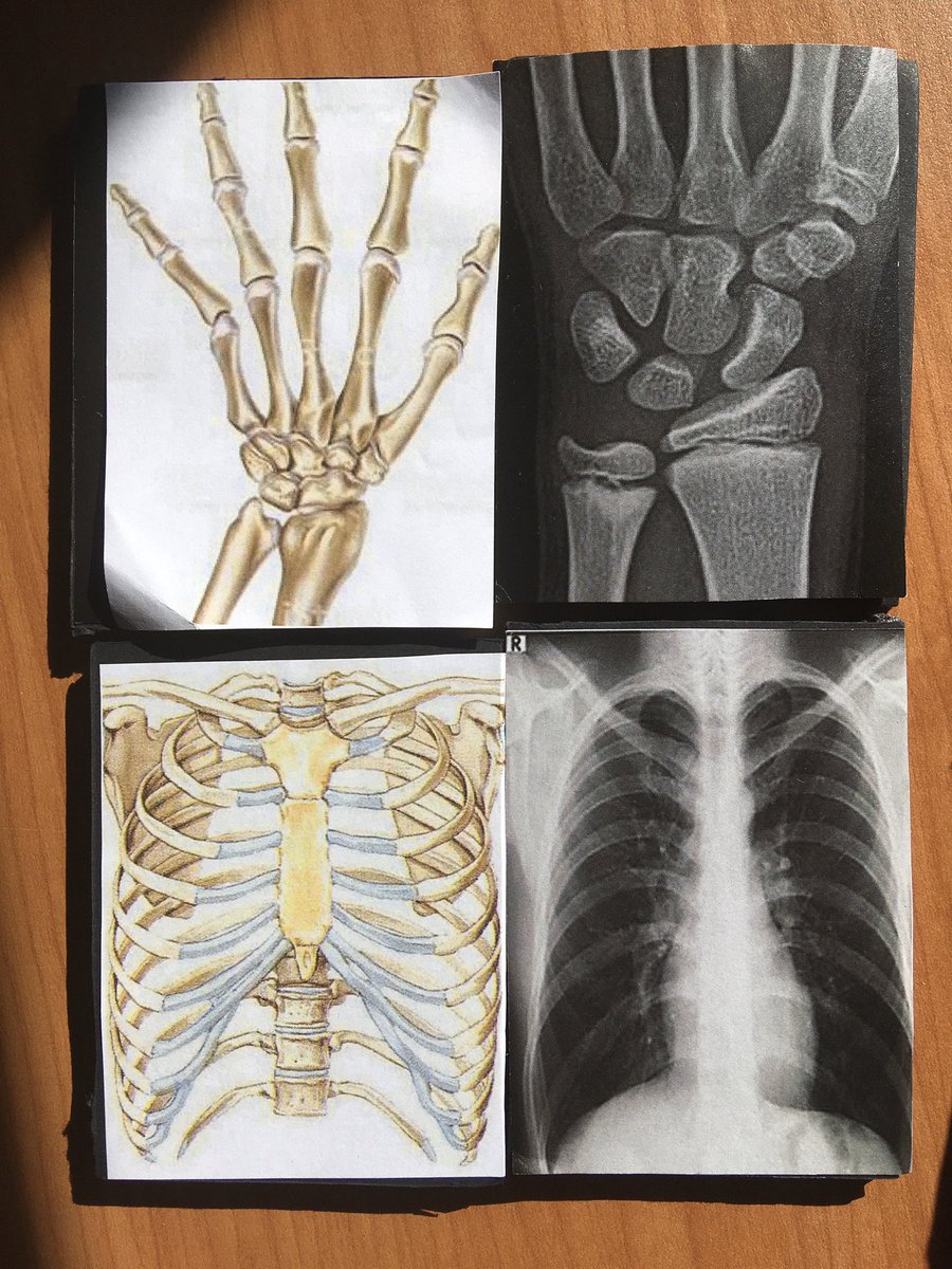 creatimagina's tweet photo. #WorldRadiographyDay #roentgen #jugarperaprendre
Alumnes de cfgs ensenyen als nens de primaria anatomia i les tècniques imatge per ajudar a perdre la por als hospitals i humanitzar la sanitat @ACTEDI #ACTIM #actitud #Neurociencia https://t.co/eSOxGVbQwq