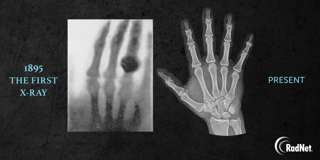 ProstateMRI's tweet image. We’ve come a long way since 1895. Happy International Day of Radiology!
#RadNet #InternationalDayOfRadiology #Radiology
