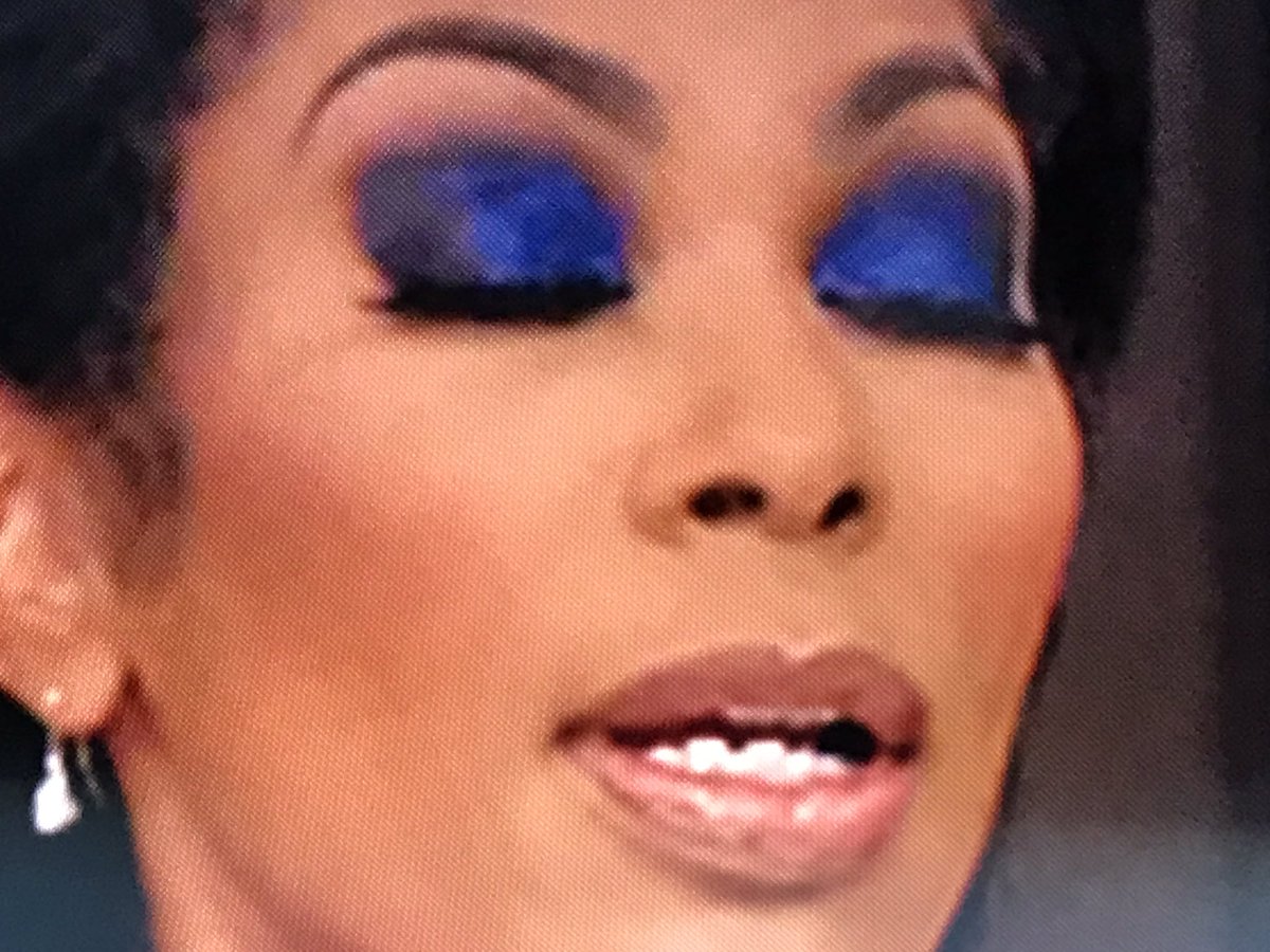 LyndaBauer11's tweet image. Halloween is over! Tone down your eye makeup and lashes! You look like a clown. And FIX YOUR TEETH! You make enough money to afford it! @FoxNews @HARRISFAULKNER @OutnumberedFNC #fixyourteeth