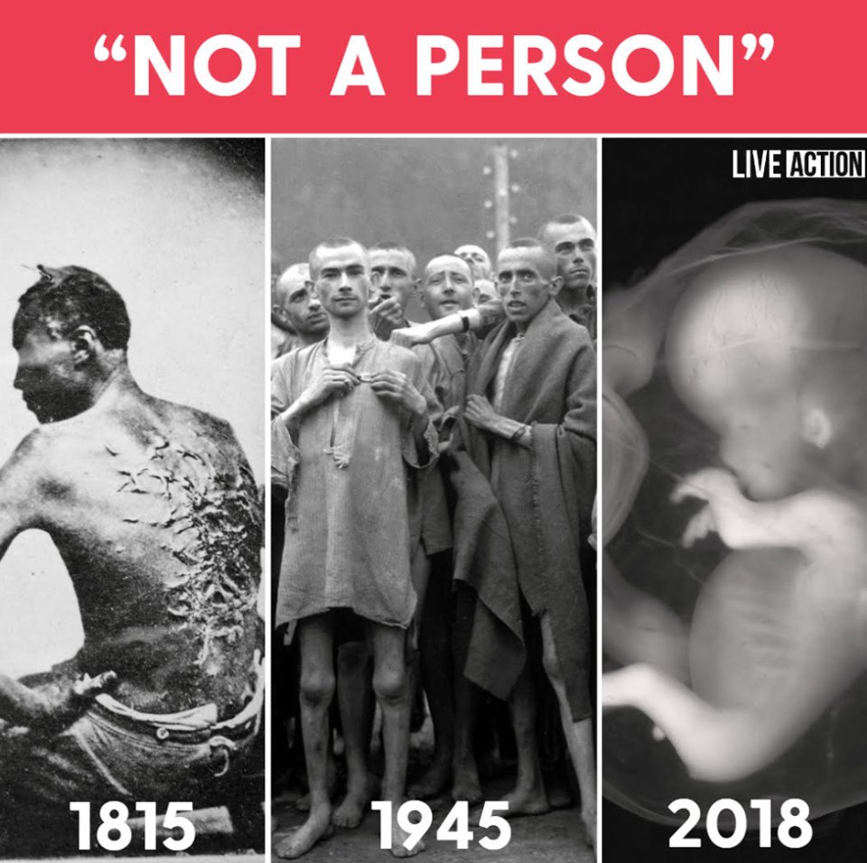 Every human rights injustice in history began with claiming its victims were “not people.” 

We must stop allowing history to repeat itself.