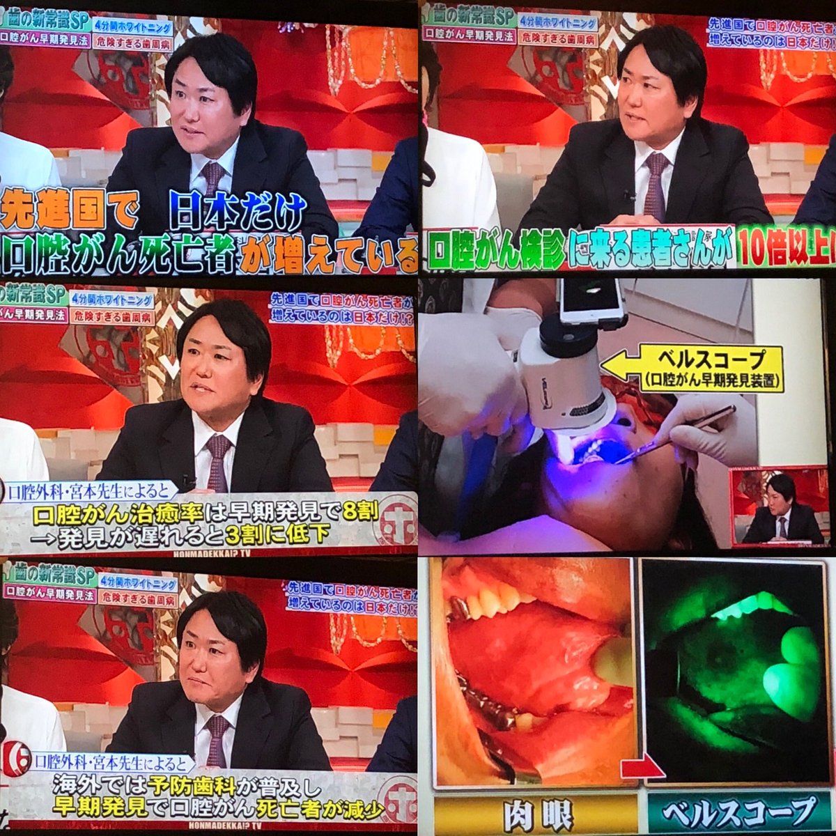 口腔ガン Twitter Search