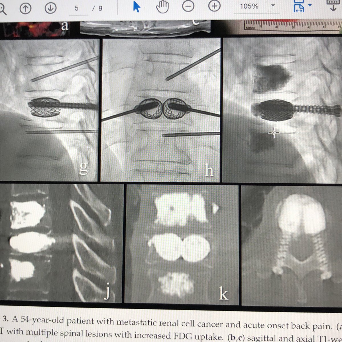 Josh Hirsch tweet media