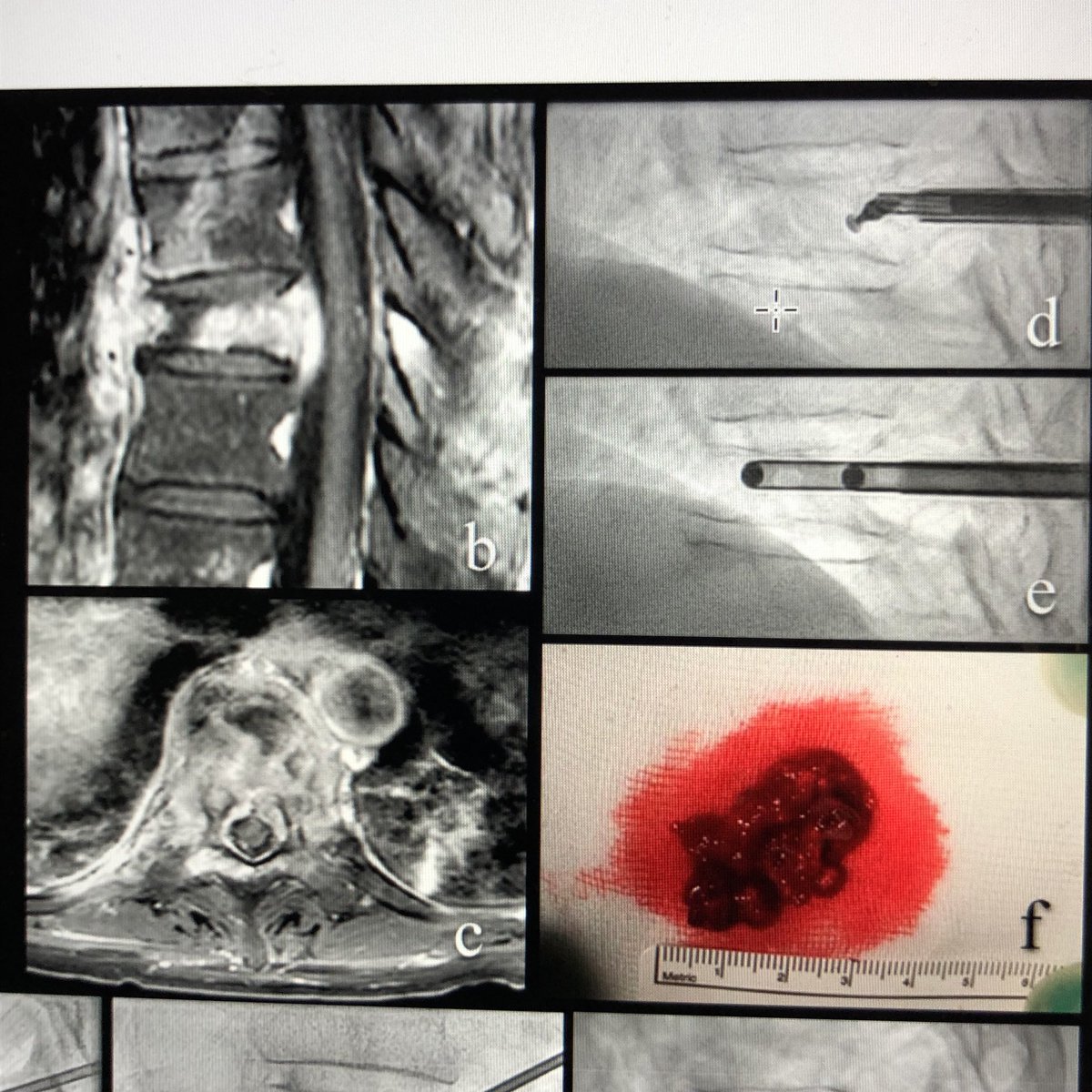 Josh Hirsch tweet media