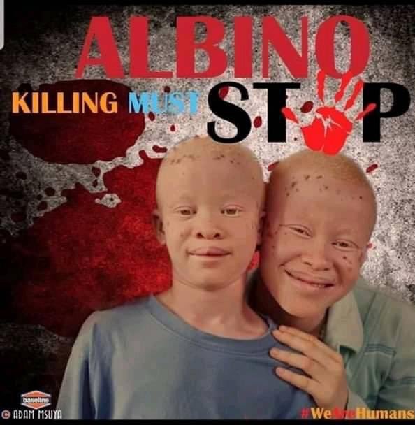 music_lazarus's tweet image. #albinism #malawi #humanhunting