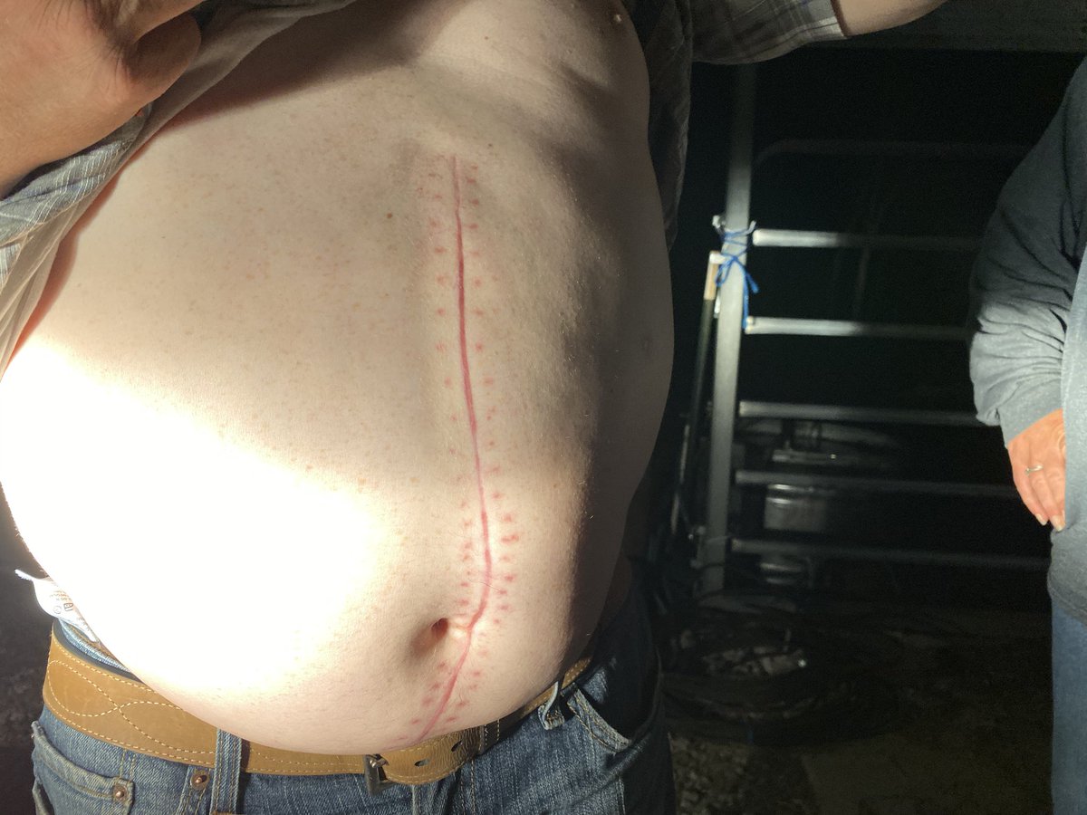 StefaniaOkolie's tweet photo. Greg has been viciously attacked by his cow 2 times. 9 weeks ago she almost ended his life. Tonight when asked why he still cares for her he tells me he just can’t give her up... but has a lesson he wants to share with others on how to protect themselves ....story at 10 #Abc13 https://t.co/YopZ7iSmgF