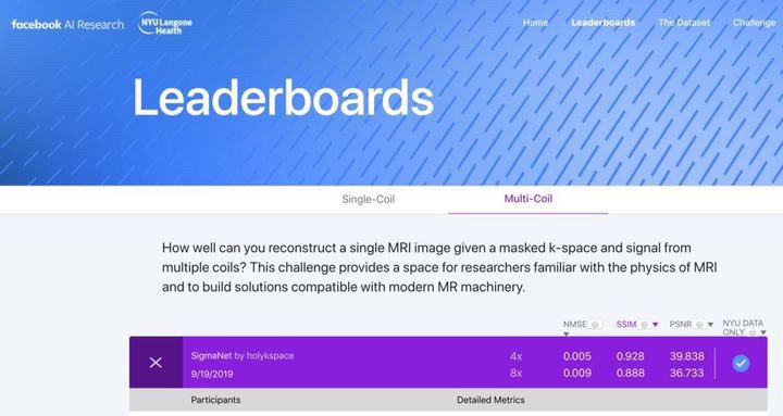 Swoop® Portable MR Imaging® System–Hyperfine, Inc (@hyperfine) on Twitter photo Meanwhile, back at the lab...
<a href="/J_Schlemper/">Jo Schlemper</a>, a member of #teamholykspace, has joined @HyperfineR Deep Learning to revolutionize medical imaging with the world’s first POC MRI. Congrats the team for smashing the top of #fastmri leaderboard! <a href="/khammernik/">Kerstin Hammernik</a> @Chen_qin615 @Jinming19741073 Meanwhile, back at the lab...
<a href="/J_Schlemper/">Jo Schlemper</a>, a member of #teamholykspace, has joined @HyperfineR Deep Learning to revolutionize medical imaging with the world’s first POC MRI. Congrats the team for smashing the top of #fastmri leaderboard! <a href="/khammernik/">Kerstin Hammernik</a> @Chen_qin615 @Jinming19741073