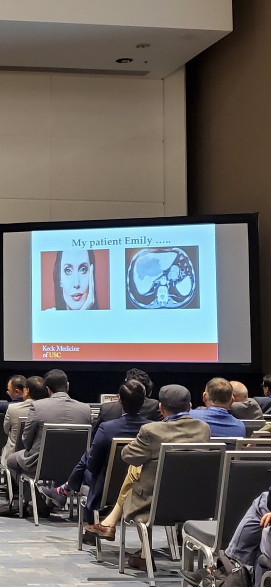 Sharpknife_Aziz's tweet photo. Presented outcomes of #liver #resections for #breast and #sarcoma patients . Thanks to @joliestweet for let me use as a surrogate for my patient “Emily” #ACSCC19 https://t.co/SFIAOfAffs