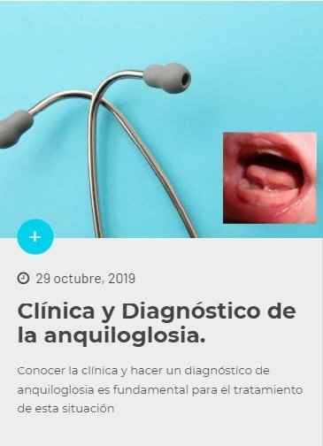 LRuizGuzman's tweet photo. Os presento la clínica y diagnostico de la anquiloglosia en lactantes importante para ayudar a las madres que con una buena postura de agarre no mejora la lactancia. Veremos en niños y en adultos próximamente. Gracias por seguirnos y por difundirlo.
https://t.co/mv7BhieKTf https://t.co/z7RvR0MM7H