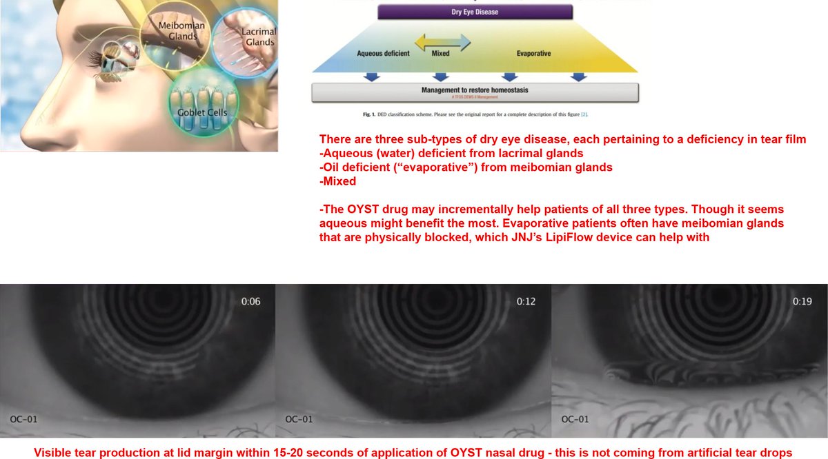 Update October 296 of 7). Here is the  $OYST drug in action. The tear production that sets in within 15-20 seconds of application is sure to provoke a visceral reaction from any dry eye patients. Looks nice.This was in the video above at 6:40 mark