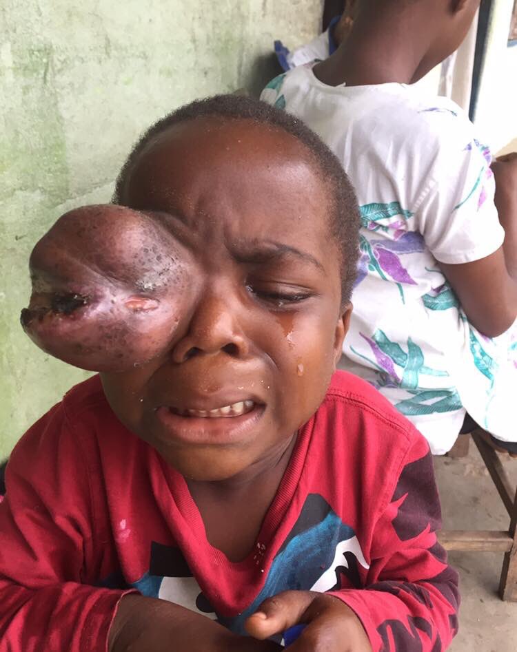 SamItauma's tweet photo. Please, help this boy for us! He’s in dire need of your help NOW! We don’t want him dead! #HelpEmma
Click link to help: https://t.co/nQXPbZ0zJv https://t.co/SdPisswuL9
