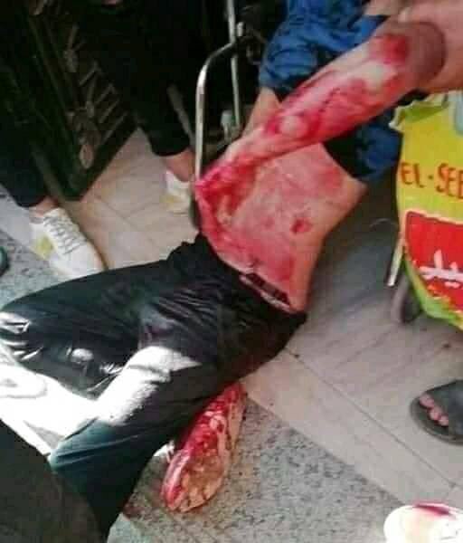 Dinamoh06425768's tweet photo. والد محمود قال لما شفت الفيديو الي بيعرض الجريمة كامله ومتعرضش قبل كدة خاص بالنيابة كنت عايز اقتص منه وهو جنبي ف القاعه باي حق تمنعوا شرع ربنا يتحقق باي حق تخلوا أبوه وأهله وأصحابه ف الالم والحسرة دي
   #مش_هنسكت_لو_هنموت_حق_البنا_مش_هيموت https://t.co/U8UaEyWz6k
