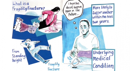 WeAreARMA's tweet photo. A fifth of women who break a bone then break another three or more before being diagnosed with #osteoporosis. This animation for patients from @RoyalOsteoSoc and @RCP_FFFAP and others helps prevent this. https://t.co/iw0o658ubF #bones #MSK #NHS https://t.co/bYjyBLJXca