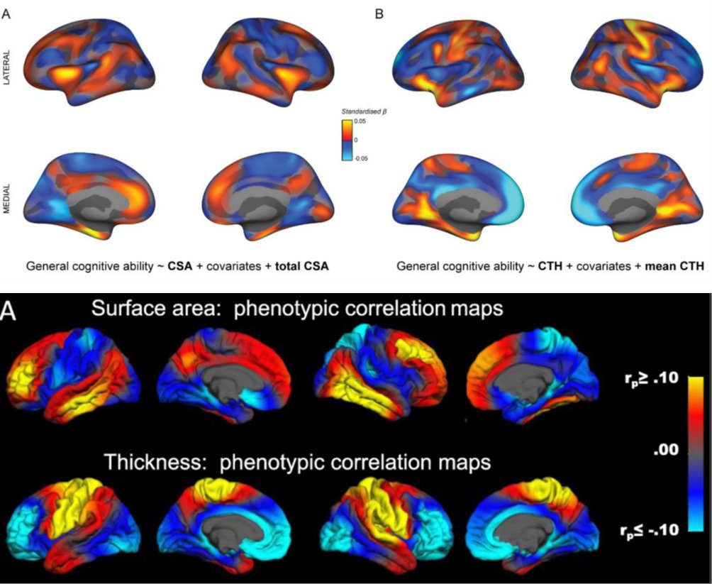 Eero Vuoksimaa (@vuoksimaa) on Twitter photo Great preprint from Palmer et al. #ABCDstudy <a href="/UCSDMedSchool/">UC San Diego School of Medicine</a> biorxiv.org/content/10.110…
Importance of cortical configuration for cognitive ability in 10 145 children (above).
Vuoksimaa et al. 2016 #NeuroImage (below): cortical
configuration and cognitive ability in adults Great preprint from Palmer et al. #ABCDstudy <a href="/UCSDMedSchool/">UC San Diego School of Medicine</a> biorxiv.org/content/10.110…
Importance of cortical configuration for cognitive ability in 10 145 children (above).
Vuoksimaa et al. 2016 #NeuroImage (below): cortical
configuration and cognitive ability in adults