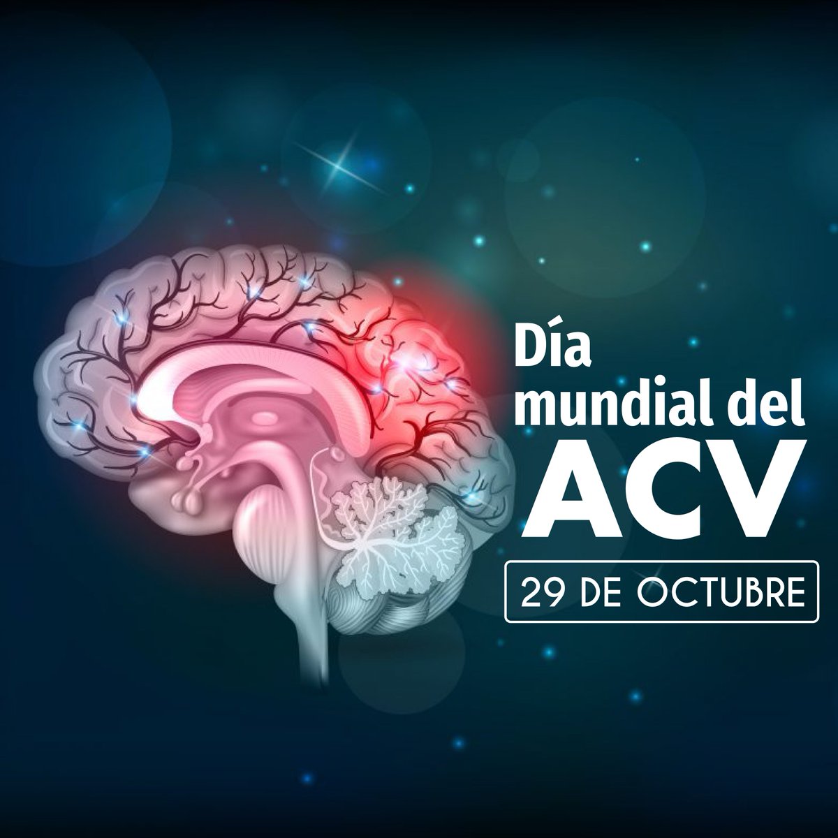 #Hoy Día mundial del #ACV