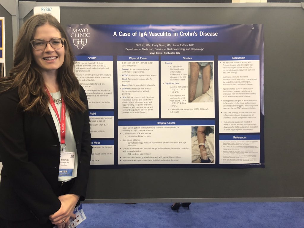 AmyOxentenkoMD's tweet image. Another day of successful presentations at #ACG2019 by residents from @MayoMN_IMRES!  Congrats to all, with some being returning presenters from yesterday!  

@EliVothMD @GColbensonMD #DrCharlesMeade #DrLaurensJanssens