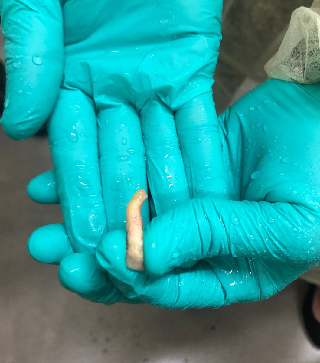 ActeonUSA's tweet photo. Can you imagine trying to remove this tooth without Piezotome CUBE? Thanks to #ACTEON rep Devon Bradford and @EngelInstitute for the photo! #DentalSurgery #Surgery #tooth #extraction #piezocube https://t.co/JMwjSgoUHU