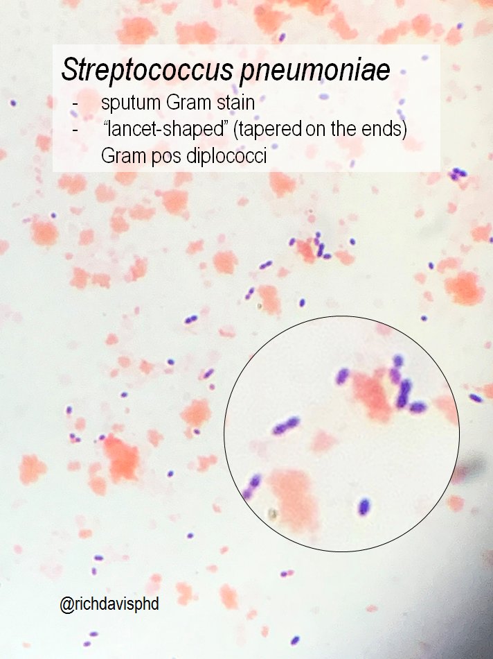 Rich Davis, PhD, D(ABMM), MLS 🇺🇦 on Twitter "MicroRounds (Day 551