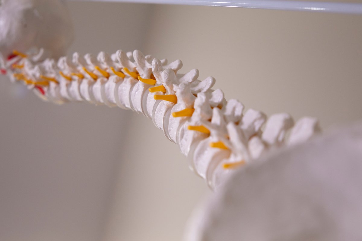 Laminectomy, Minimally Invasive, XLIF, ALIF, discectomy, fusion; many problems, many solutions. Know what questions to ask before your back surgery! Three surgeons discuss the options: amzn.to/33XqZT4 #OptimizedPatient  #SpineRecovery #SpineSurgery