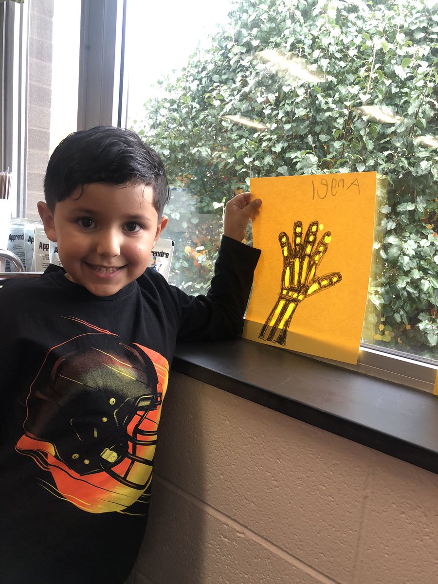 kinder_stem's tweet photo. Making our very own X-Rays in STEM this week. #KinderStem https://t.co/KMfhcpaLPc