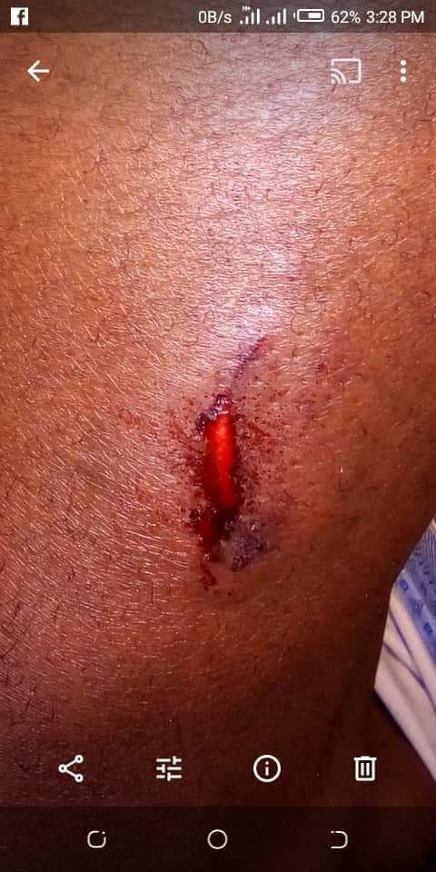 BobiSonia's tweet photo. Two journalists Alex Esagala- Monitor and a one camera person Jeff of NTV are nursing wounds after being buttered by military police as they covered Makerere tuition demonstrations. Your prayers are needed for them.
#FresMustFall
#MusveniMustFall https://t.co/aR2CKQF1vy