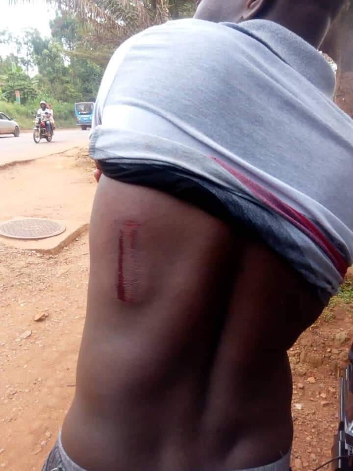 BobiSonia's tweet photo. Two journalists Alex Esagala- Monitor and a one camera person Jeff of NTV are nursing wounds after being buttered by military police as they covered Makerere tuition demonstrations. Your prayers are needed for them.
#FresMustFall
#MusveniMustFall https://t.co/aR2CKQF1vy