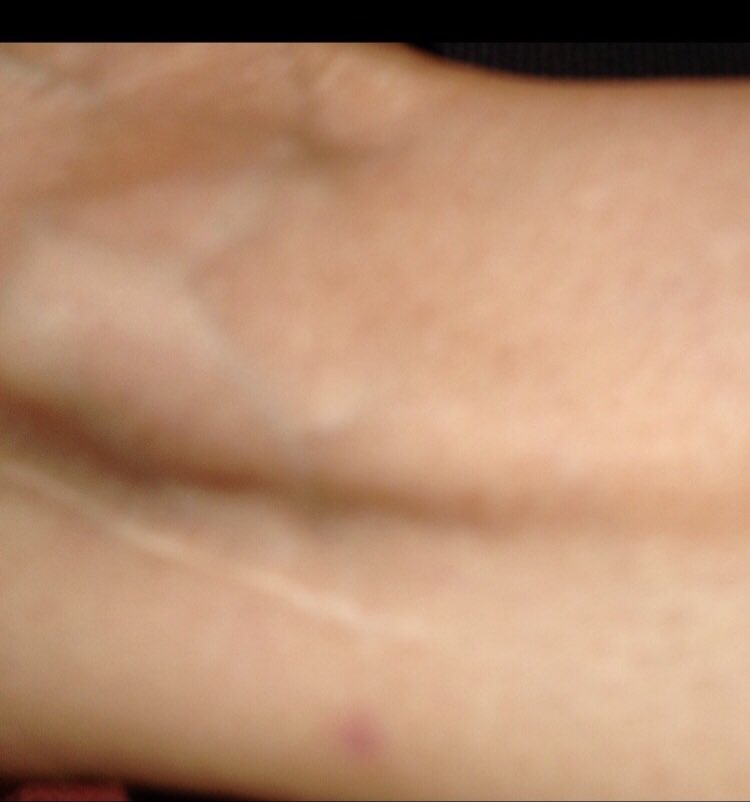 KistenNoel's tweet photo. #BigPharma #Merck #MRK @HHSGov @POTUS @4UWell #KennethFrazier @WhiteHouse @NJTVNews IF HUMANITY does NOT INCLUDE T irreversibly harmed , then exactly what is THE HUMANITY PRACTICED at Pharmaceutical⁉️If compassion stops at T injured 🤕 then WHAT is T COMPASSION @Merck SINGULAIR https://t.co/rwrjlW0H9u