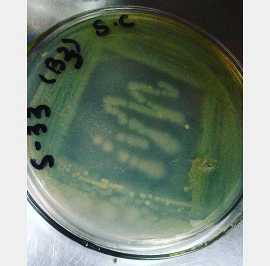 hajarkagalwaa's tweet photo. #pseudo on #nutient #agar
#green #microbiology #lab #isolation https://t.co/vbhSzdvfsU