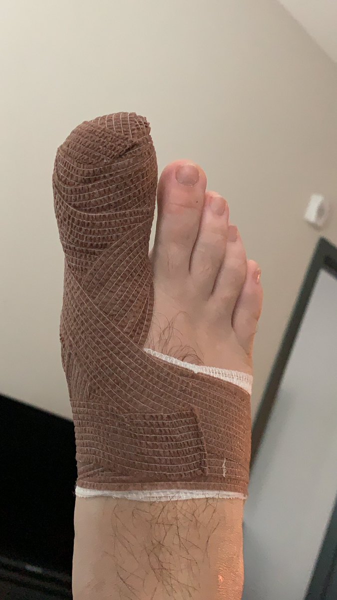 Jack7Patterson's tweet photo. @DannyDeVito toe knife incident. #Botched https://t.co/Gczhu44g68