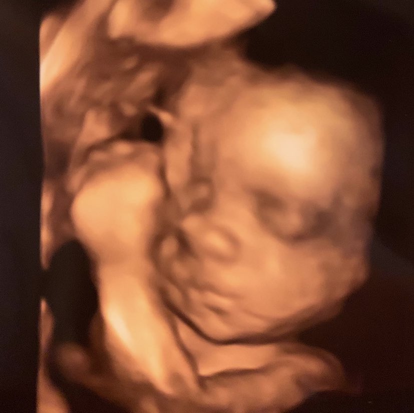 CaseeeyyLee's tweet photo. Less than a month until I get to hold this little guy in my arms 🥰😭 I am so so blessed https://t.co/ota3NRzPpr