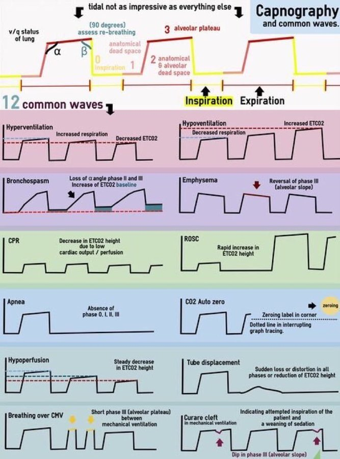 Las 12 Ondas Capnográficas más habituales!!!
Un Resumen bastante Completo!!!