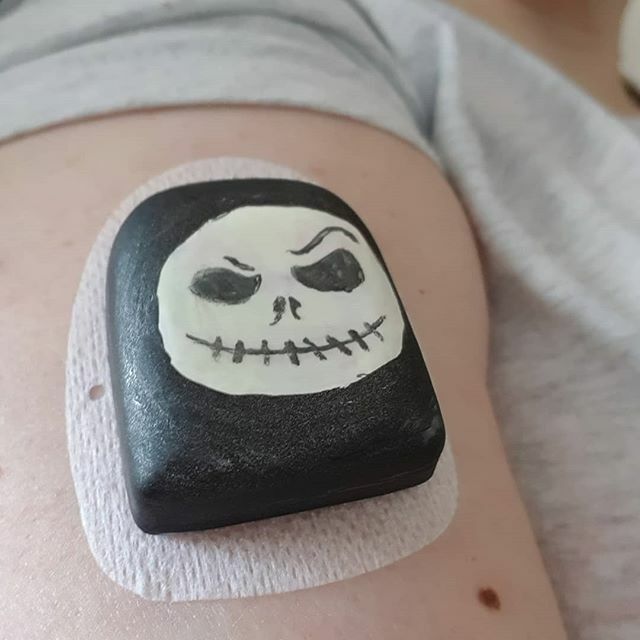 Other_Ryn's tweet image. It&apos;s the most wonderful pod of the year!

#omnipod #pimpmypod #nightmarebeforechristmas #jackskellington