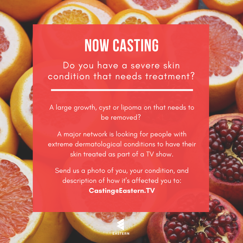 EasternTV's tweet image. Do you have a severe skin condition that needs treatment?

A major network is looking for people with extreme dermatological conditions to have their skin treated as part of a TV show.

Send a photo of your condition and description of how it's affected you to casting@eastern.tv