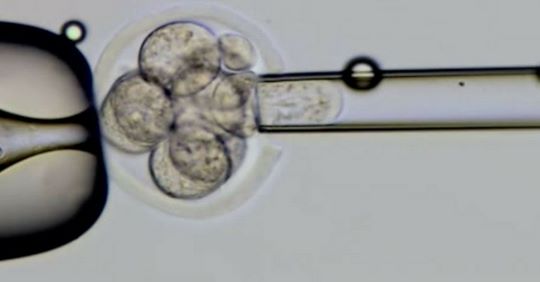 IIRFTINDIA's tweet photo. How Does Embryology Course Make a Difference in Your Career?
More Info:- https://t.co/1IY0eSdwnT
For more queries mail us at Email:-contact@iirft.com.
Mobile:- +91-9555544428
#Embryology #ART #EmbryologyTraining #IIRFT https://t.co/o3aRfDMzUG