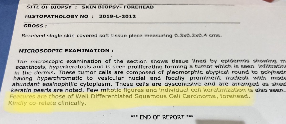 dermatdoc's tweet photo. Scary scenario but today’s #pollution #environment stress, chemicals in food, cosmetics,air, rain,water will lead to more such lesions #squamouscellca #skincancer can be fatal&deadly..one such case I diagnosed recently but sharing as this is getting more common than we imagine😓 https://t.co/NSffk3Lg61