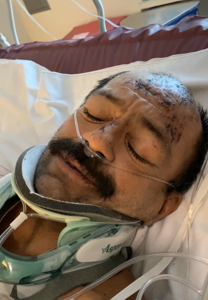 #OnlyOn <a href="/CBSLA/">This is (not) CBS Los Angeles 👁️</a>: After watching our story, an auto repair shop owner realized the Mini Cooper involved in a bicyclist hit &amp; run in #SilverLake was brought to his shop. <a href="/LAPDCTD24/">LAPDCTD</a> confirms it’s the car they’ve been looking for &amp; says the owner is an <a href="/LASchools/">Los Angeles Unified</a> employee. #KCAL9 10pm